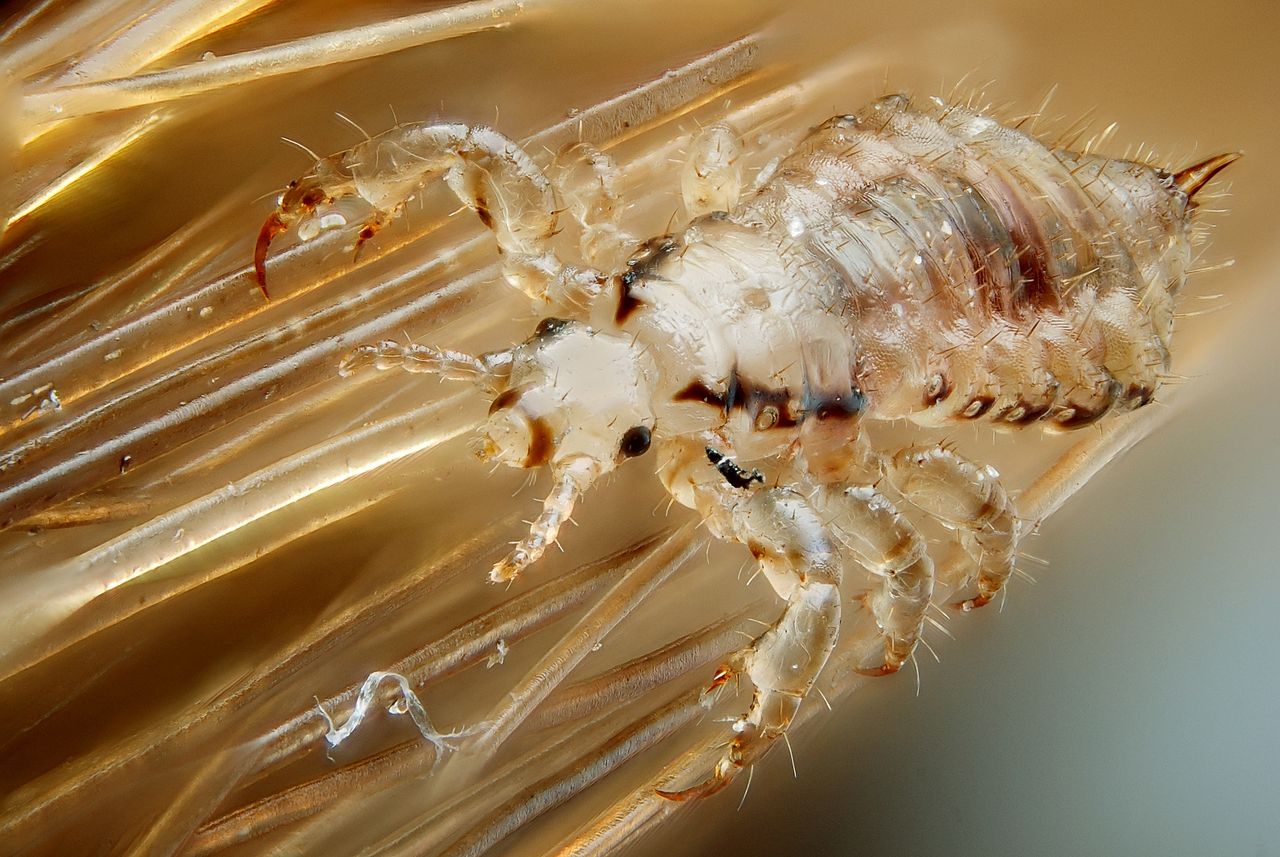 Controlling Head Lice in Phoenix – Lawnstarter
